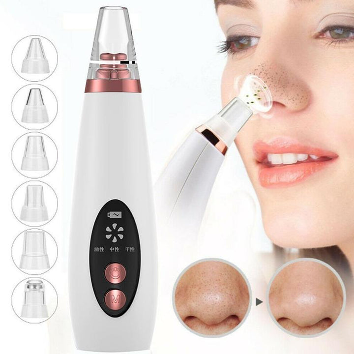 Portable Pore Vacuum — Visibly Clearer Skin in One Use
