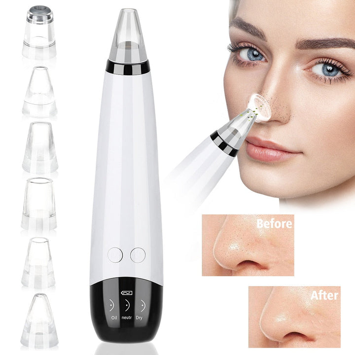 Professional Blackhead Vacuum — 6 Heads & 3 Modes