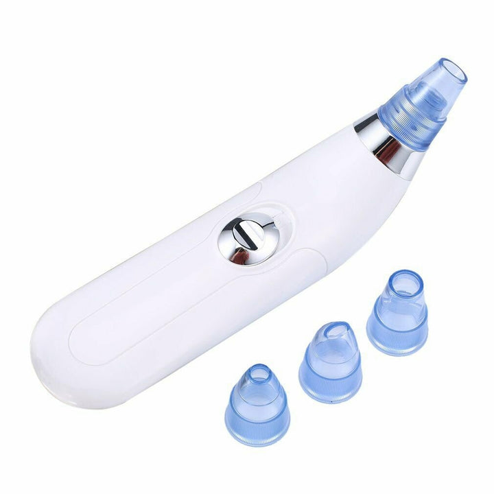 Pore Vacuum Blackhead Remover — Pain-Free Deep Cleaning