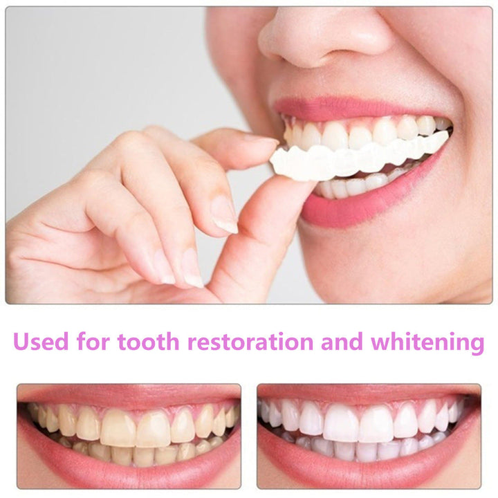 Teeth Simulation Veneers — Instant Bright Smile, No Dentist