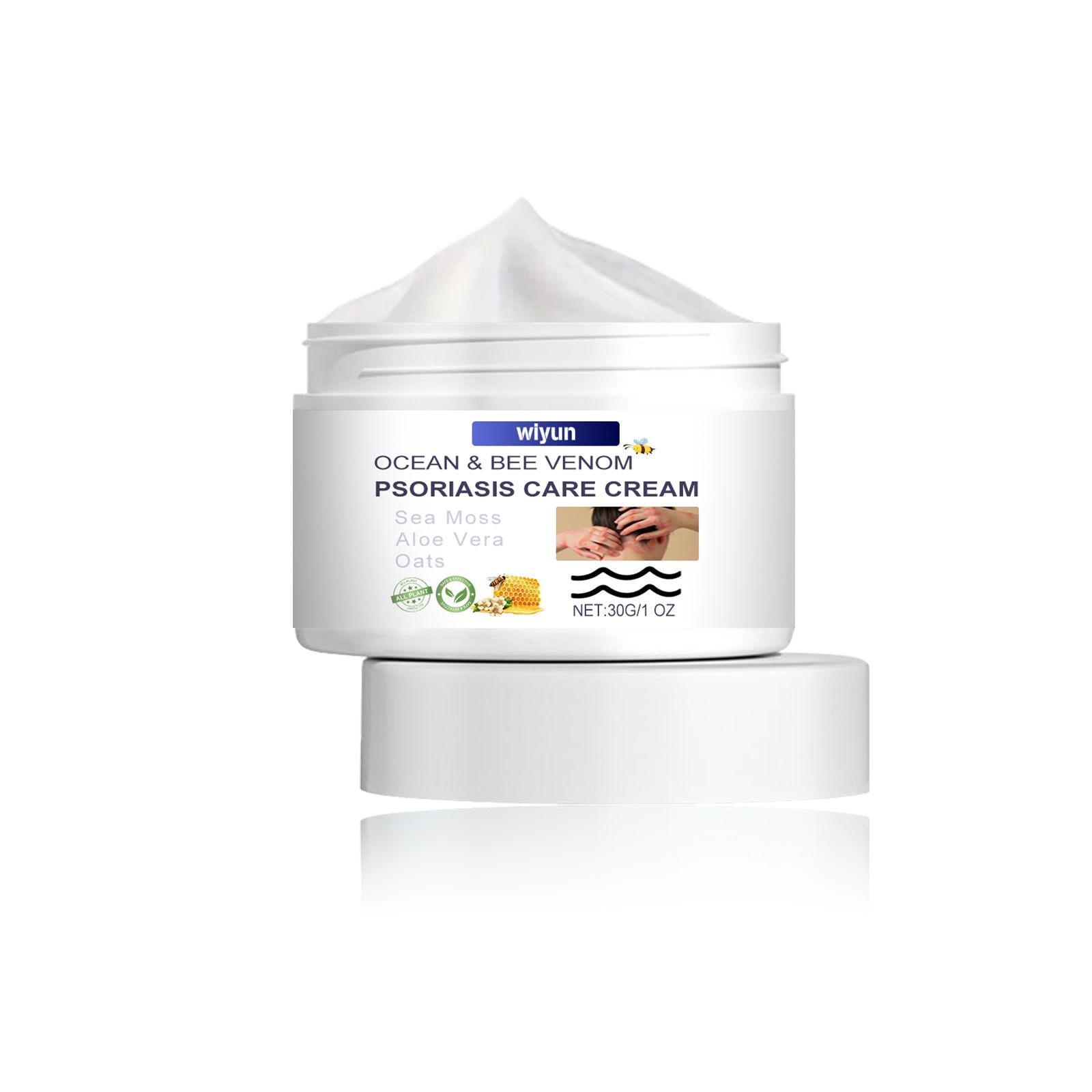 Wiyun Ocean & Bee Venom Psoriasis Care Cream in white jar with peaked texture visible, on white background