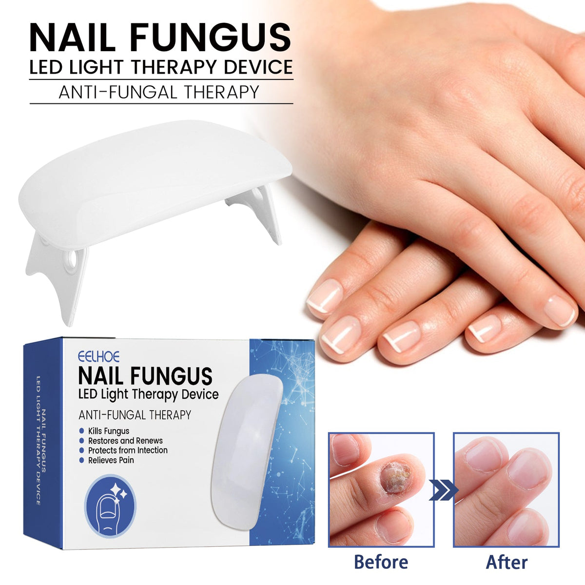 LED Nail Repair Treatment — Clear Fungus & Restore Nail