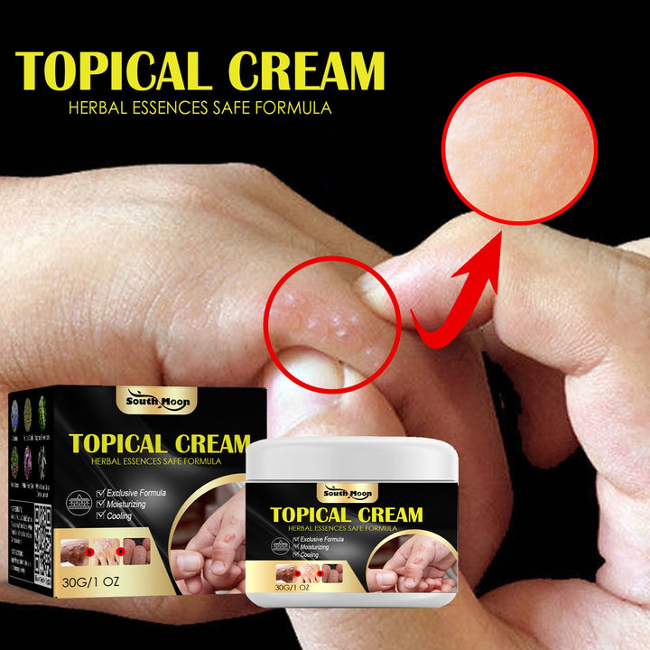 Anti-Itch Cream — Fast Herbal Relief for Bug Bites & Rashes