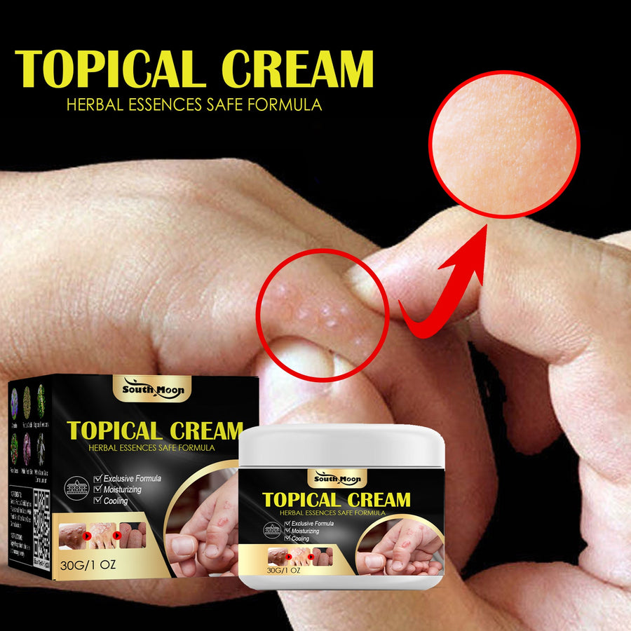 Anti-Itch Cream — Fast Herbal Relief for Bug Bites & Rashes