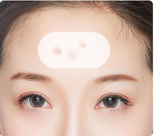 Blackhead Removal Patches for Discreet Oil Control