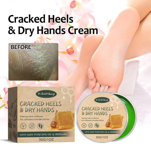 Cracked Heel Cream for Softer Hands, Feet & Calluses