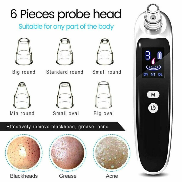 Pore Vacuum Blackhead Remover – Deep Cleansing & Clearer Skin