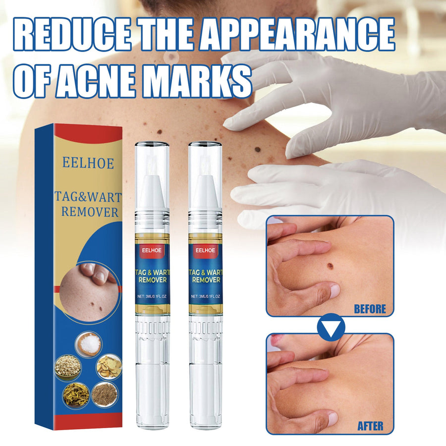 Skin Tag Treatment Pen for Precise At-Home Spot Care