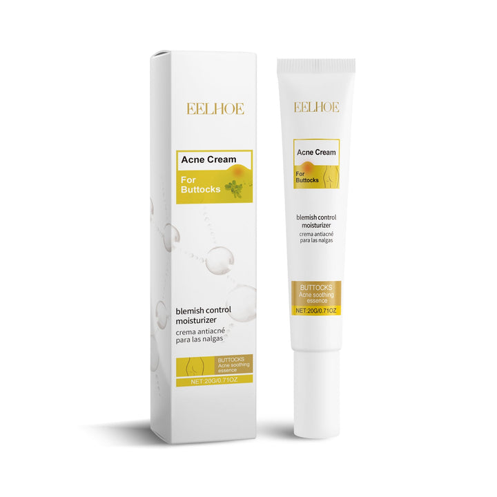 Buttne Acne Cream - Targeted Blemish Control Treatment