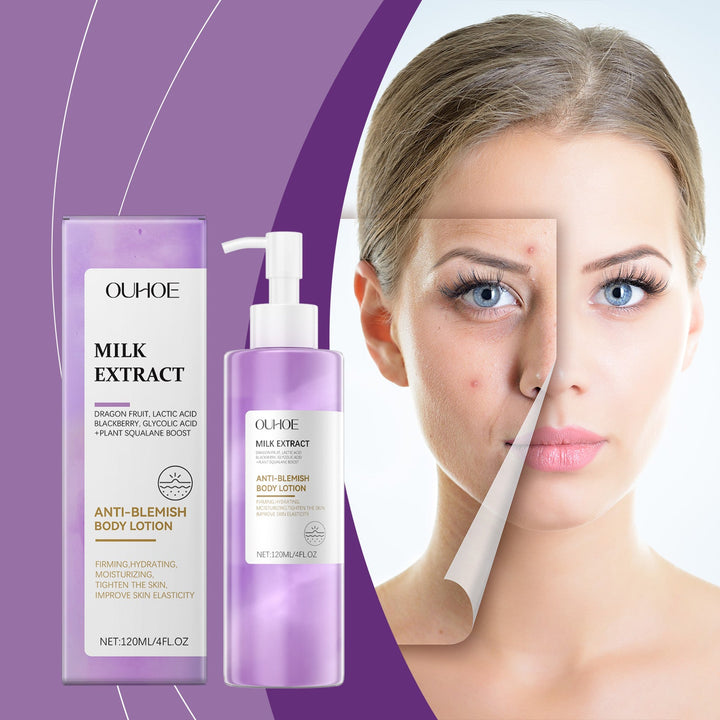 Berry Acne Body Lotion for Clearer Back & Chest Skin