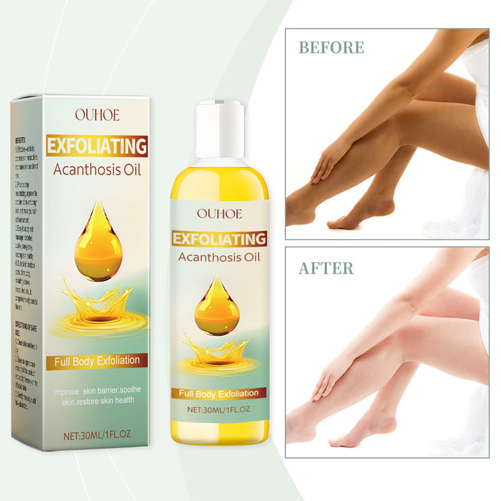 Exfoliating Body Oil for Dark Elbows & Underarms