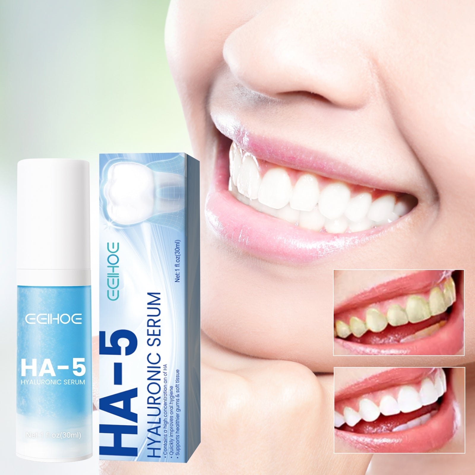 Woman with bright white smile demonstrating results, with text 'DEEP CLEANING TOOTHPASTE' and icons showing stain sources like cigarettes, wine, tea, and coffee