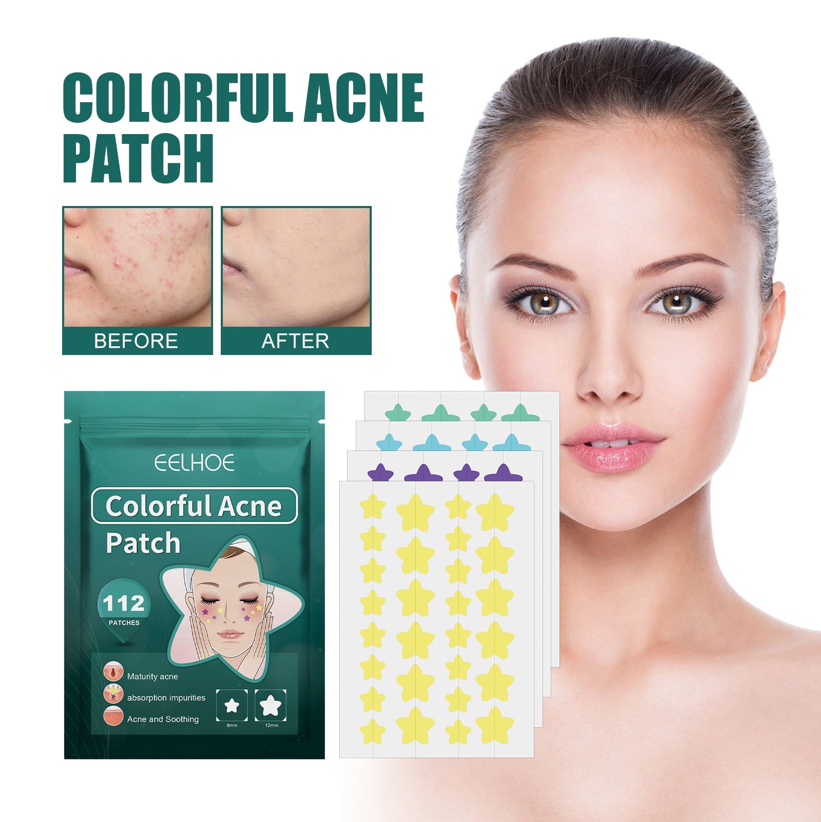 Young woman with transparent overlay showing multiple face zones and lower sections labeled FACE, BODY, and BACK demonstrating acne treatment zones