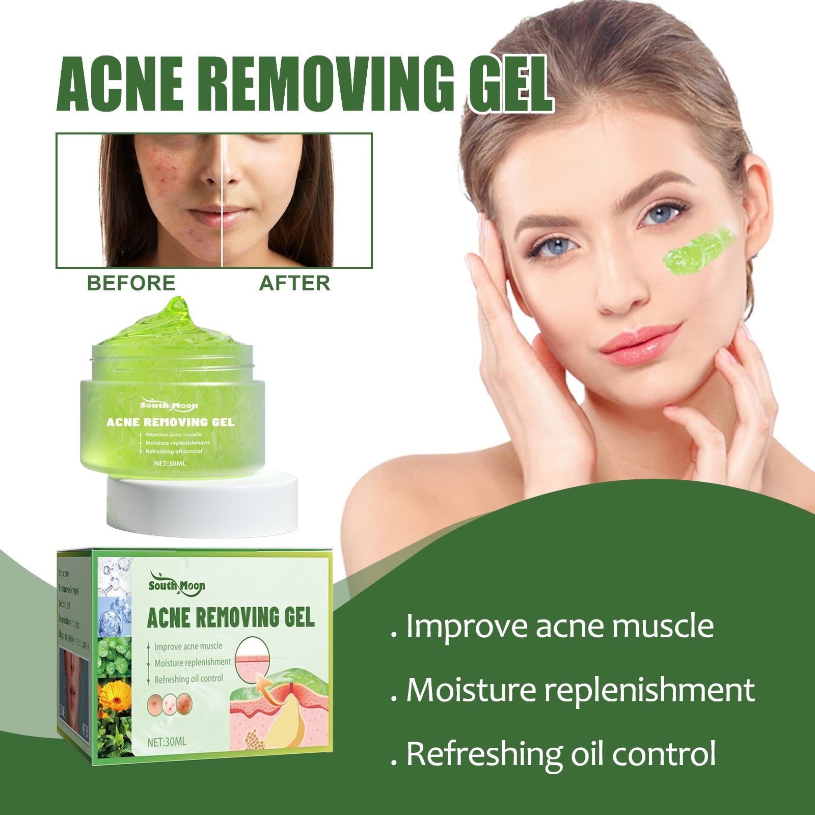 Woman's face with labeled callout circles identifying stubborn skin troubles: blackhead pores, full of oil, repetitive acne, acne closure
