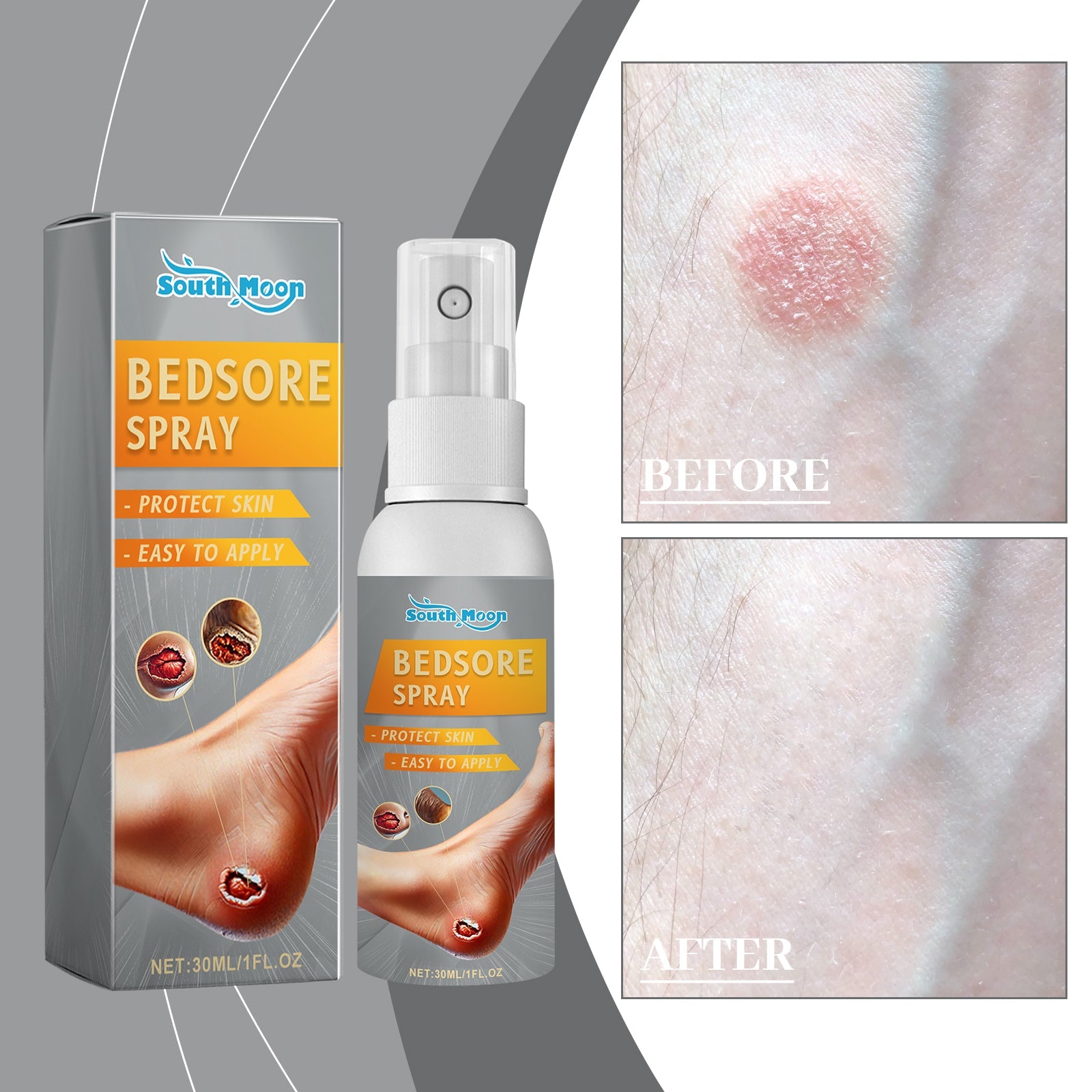 Detailed cross-section diagram of skin layers showing bedsore/pressure ulcer with 'Pain Relief' messaging below