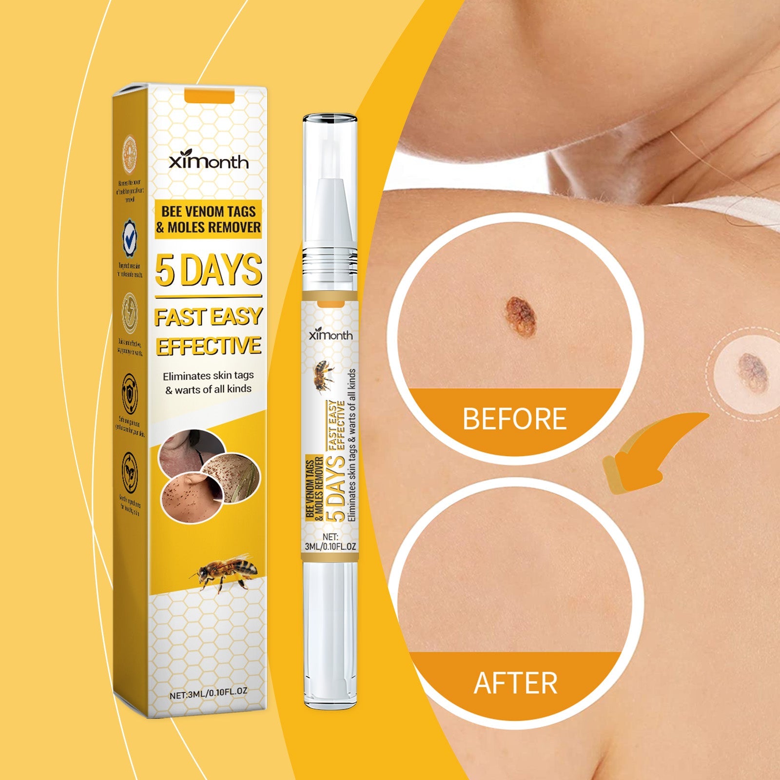 Close-up of neck/shoulder area with multiple skin tags visible and text 'PRECISE APPLICATION' explaining pen-tip mechanism