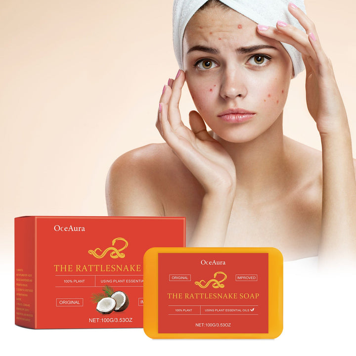 Tea Tree Acne Soap With Coconut Oil for Clear Skin