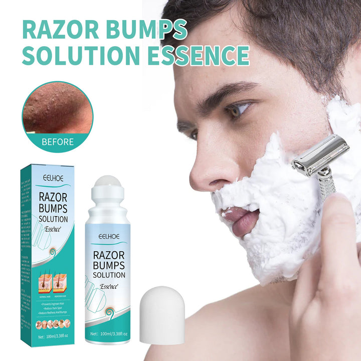 Ingrown Hair Roll-On Treatment — Prevents Razor Bumps
