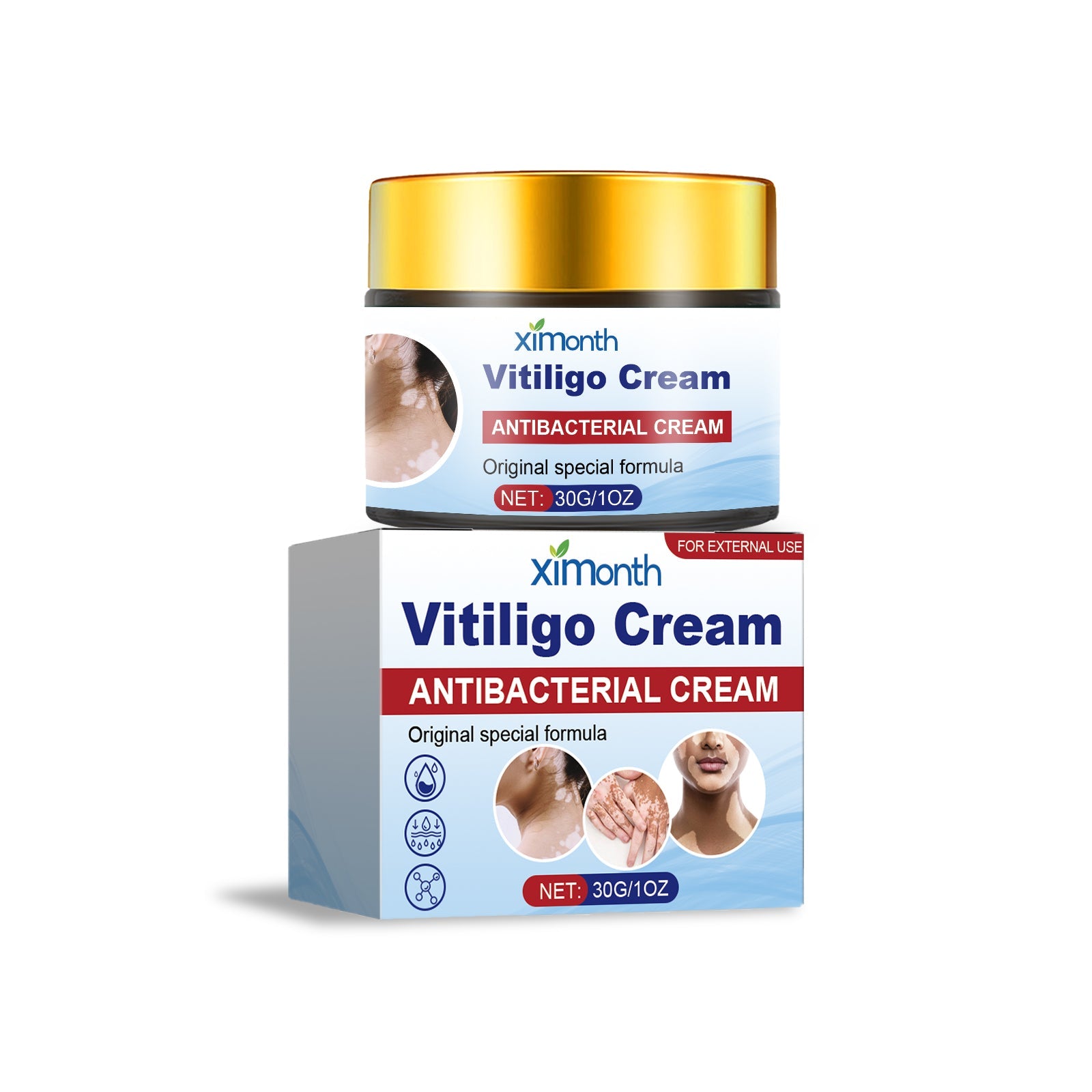Woman shown with visible vitiligo patches on shoulders and neck; product jar positioned beside, demonstrating treatment area application