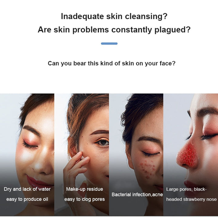 Pore Vacuum Blackhead Remover — Gentle Cyclic Moist Suction