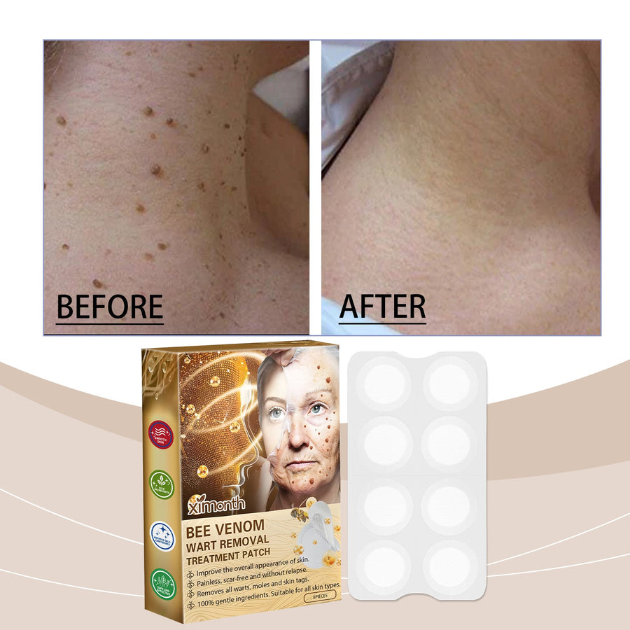 Bee Venom Treatment Patches for Targeted Skin Care