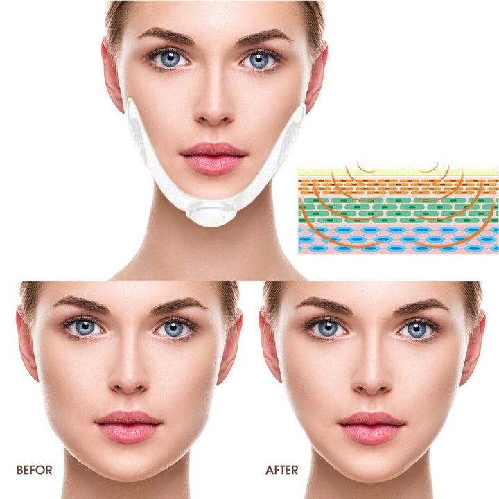 Facial EMS Lifting Device — V-Shaped Contour Care