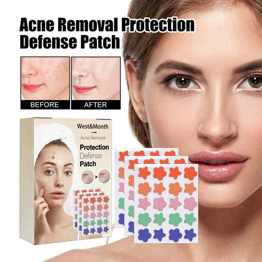 Acne Spot Patches — Treat All Pimples Invisibly, Day & Night