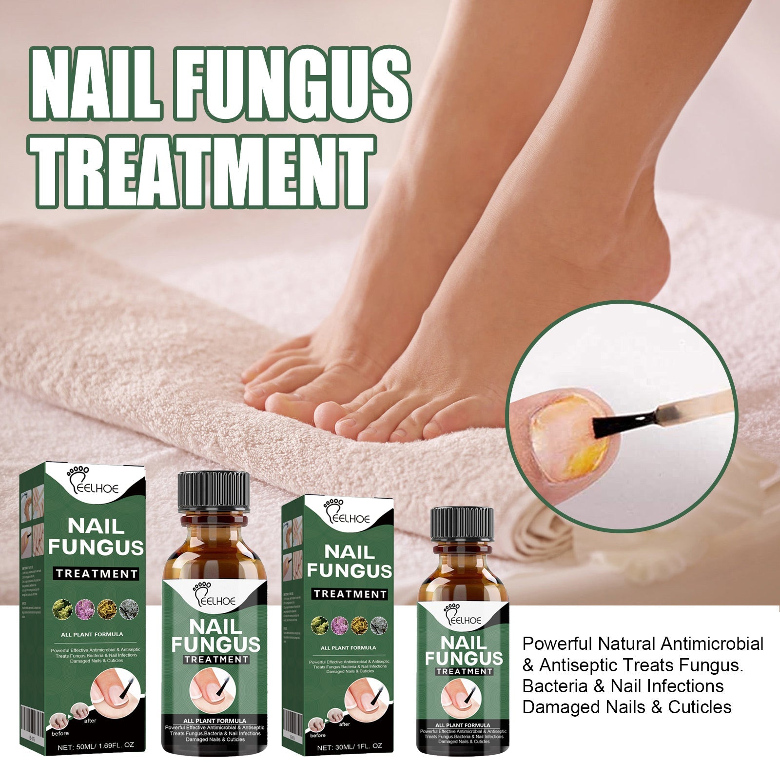 Clear three-stage before/using/after progression of toenails; before shows thick yellowed nail with severe discoloration, after shows clear pink healthy nail