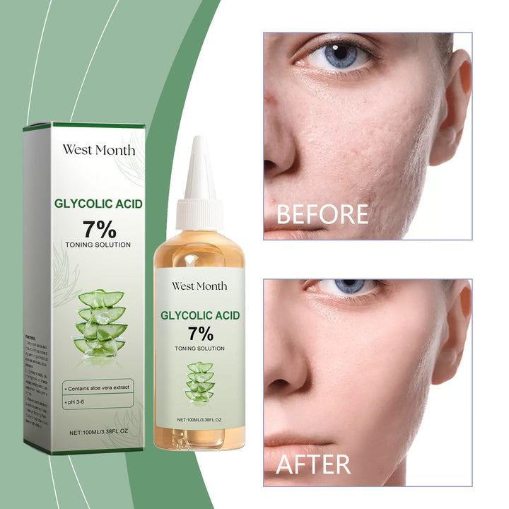 Glycolic Acid Toner 7% for Smoother, Clearer Pores