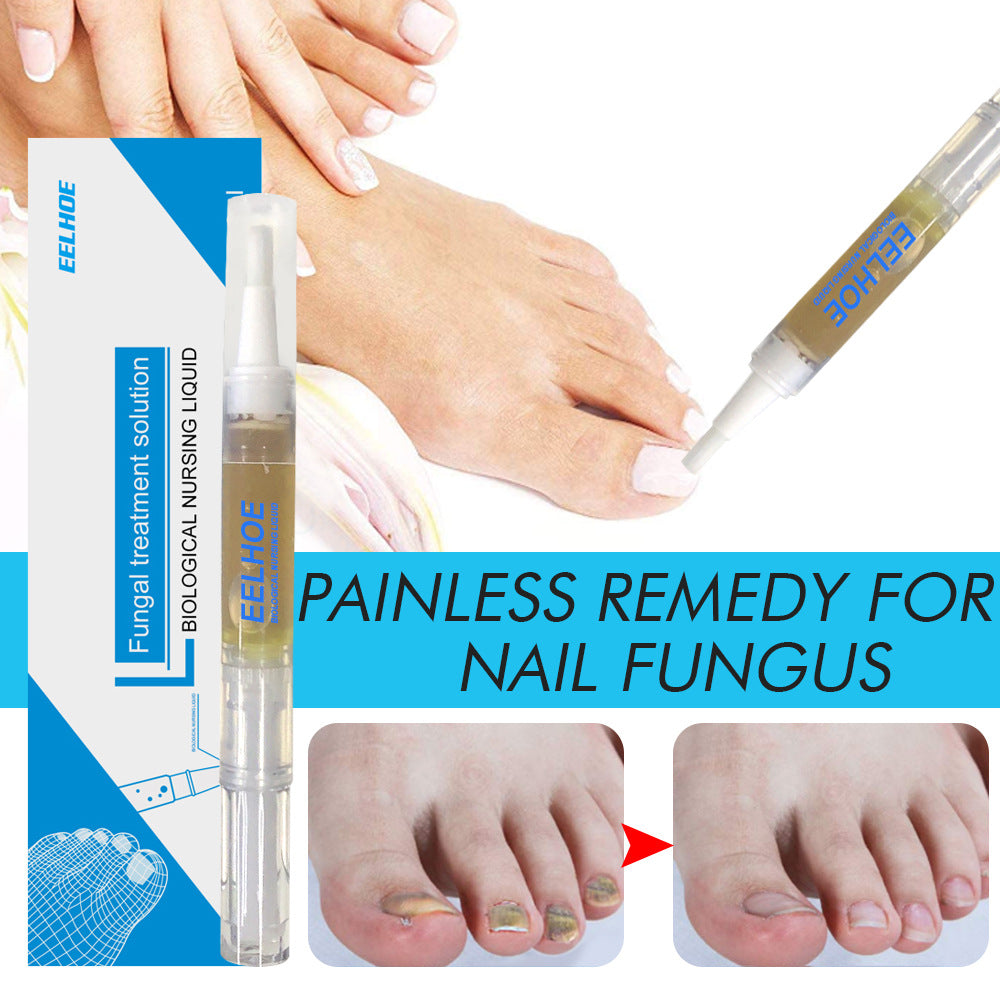 Hand application demonstration: woman applying liquid to infected toenail, before/after comparison showing diseased yellow/brown toenails transforming to clear healthy nails