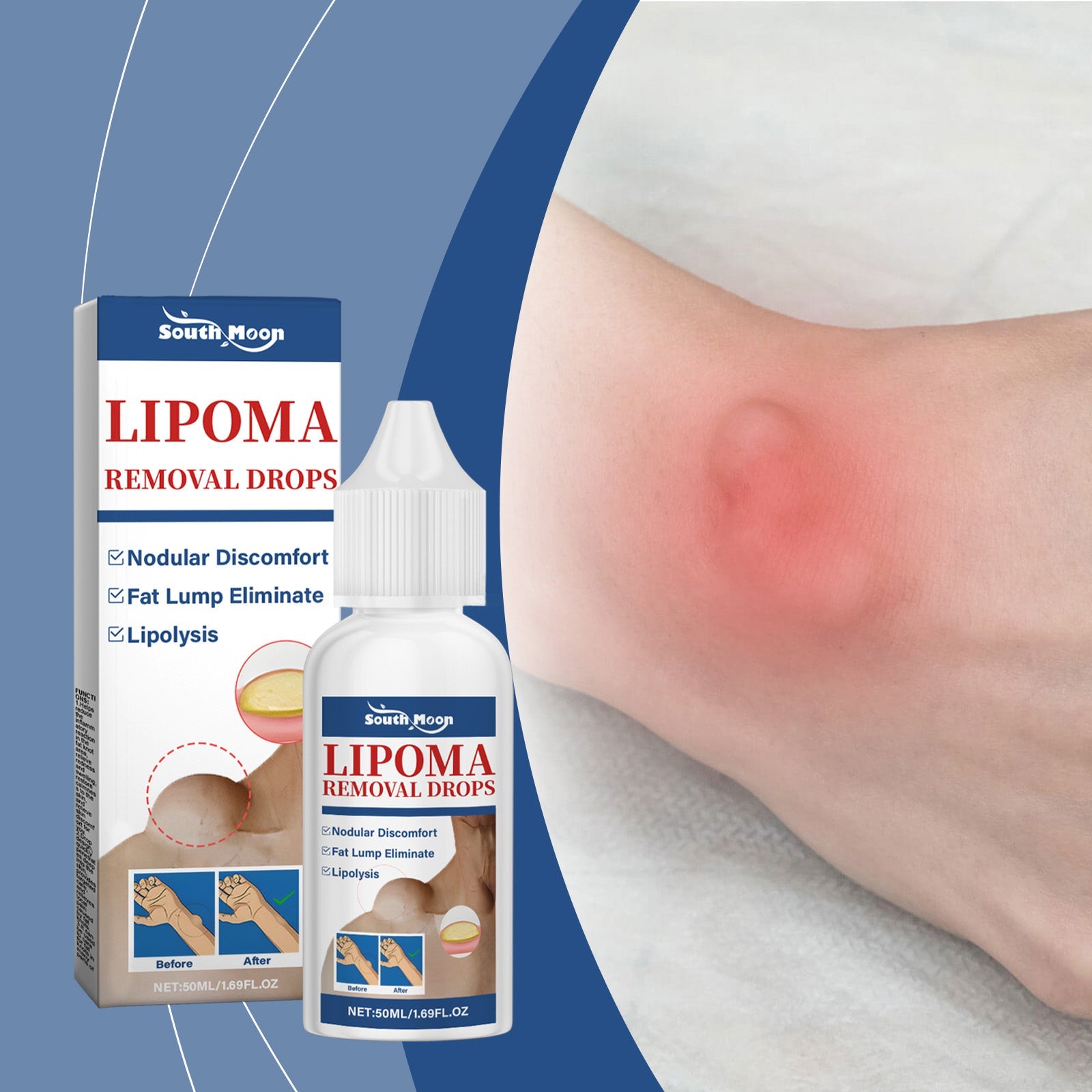 Product bottle and box positioned against blue gradient background with close-up of inflamed skin area showing redness