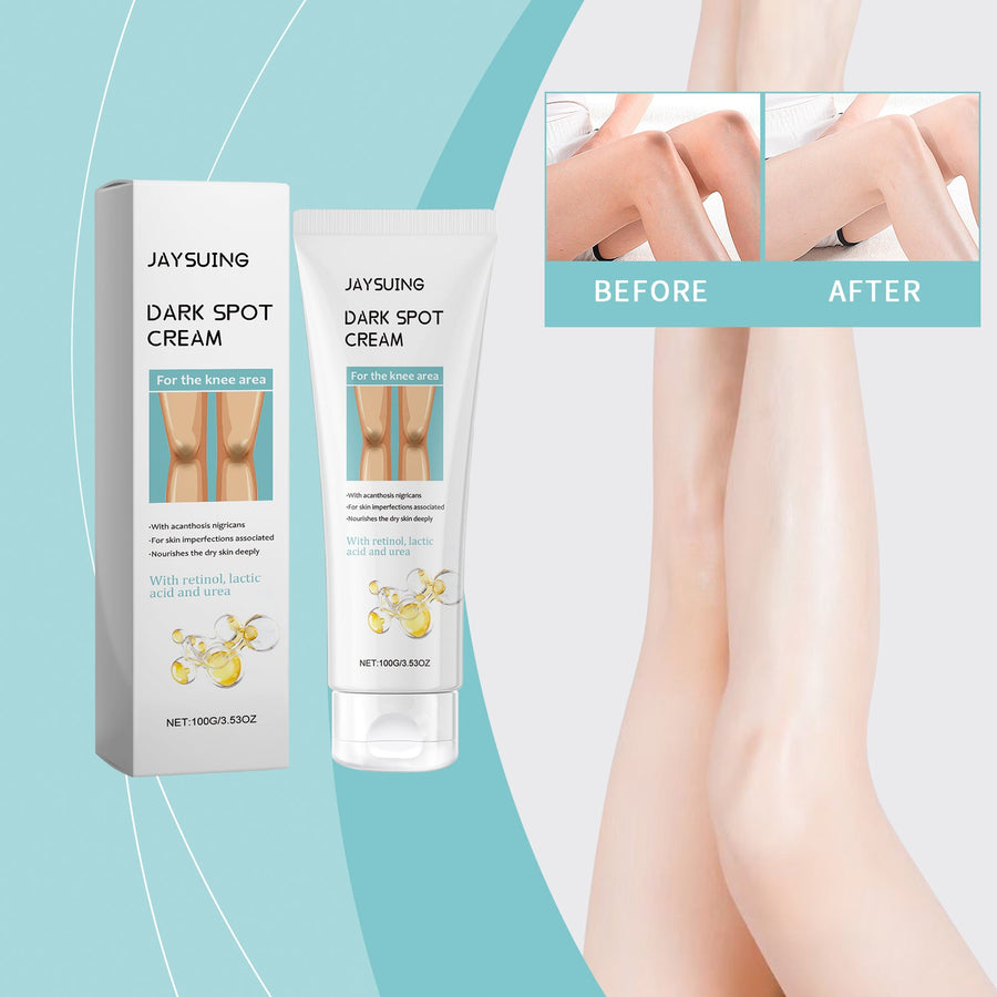 Knee Dark Spot Cream for Brighter, Smoother-Looking Skin