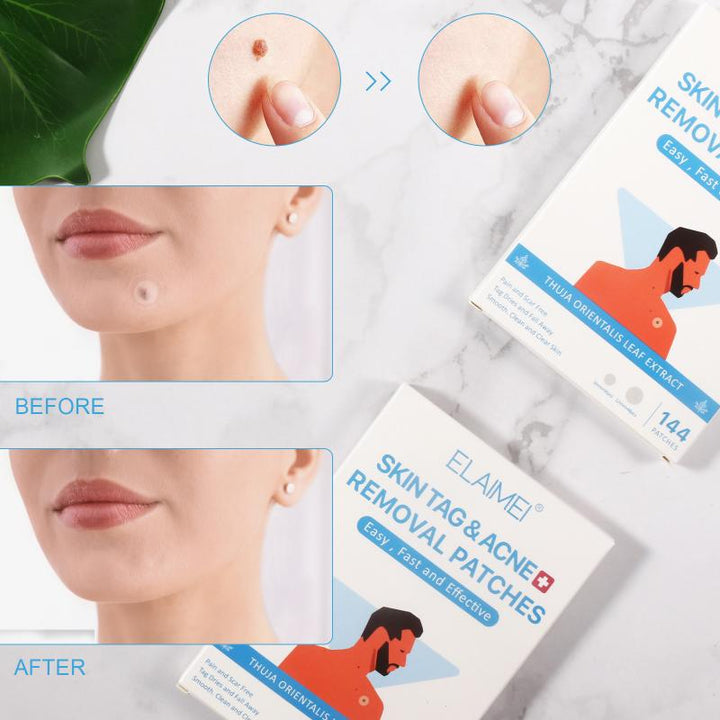 Skin Tag Removal Patches — Pain-Free, Clear Skin in 12 Hours