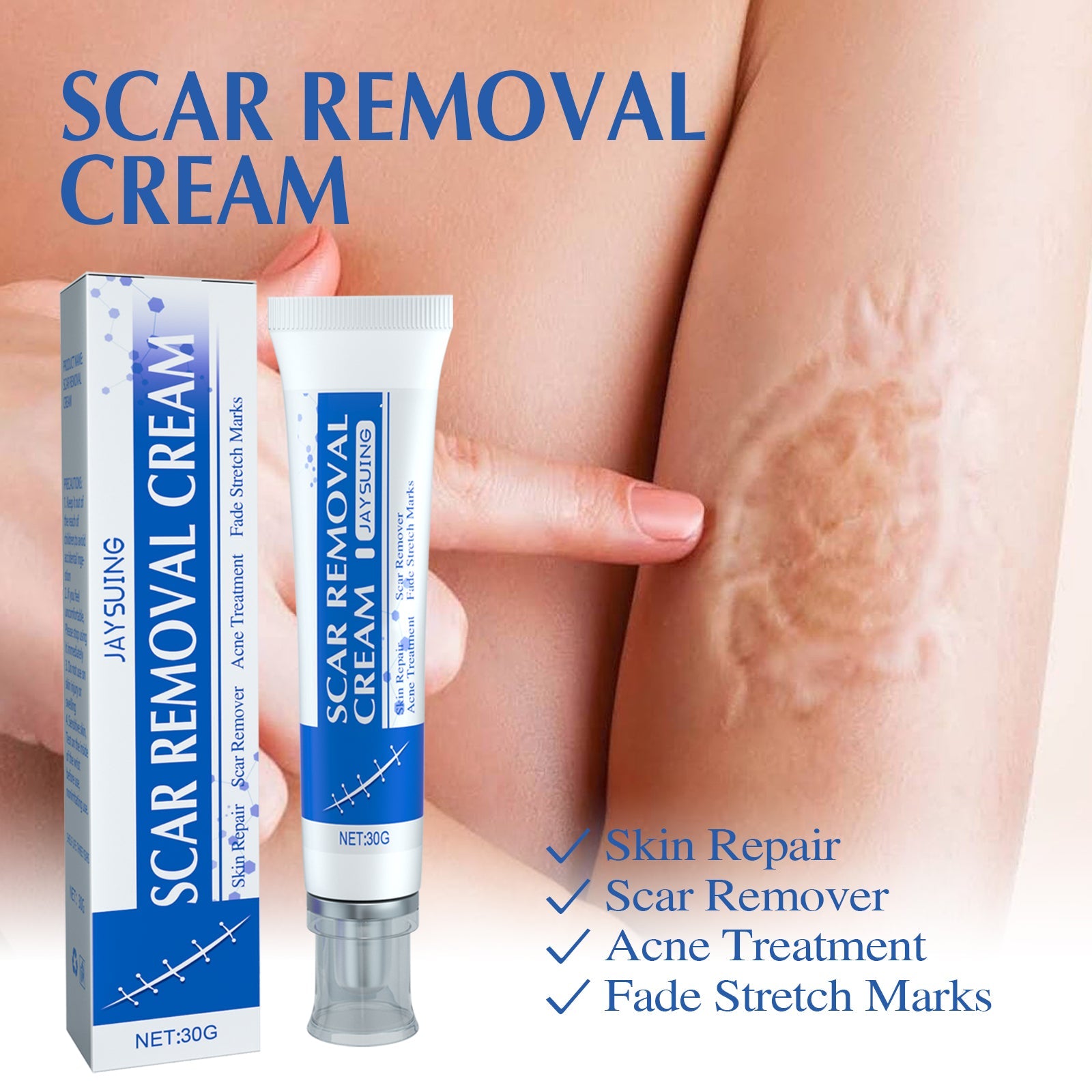 Hand applying cream to visible scar on skin with product and packaging displayed, showing real-world application