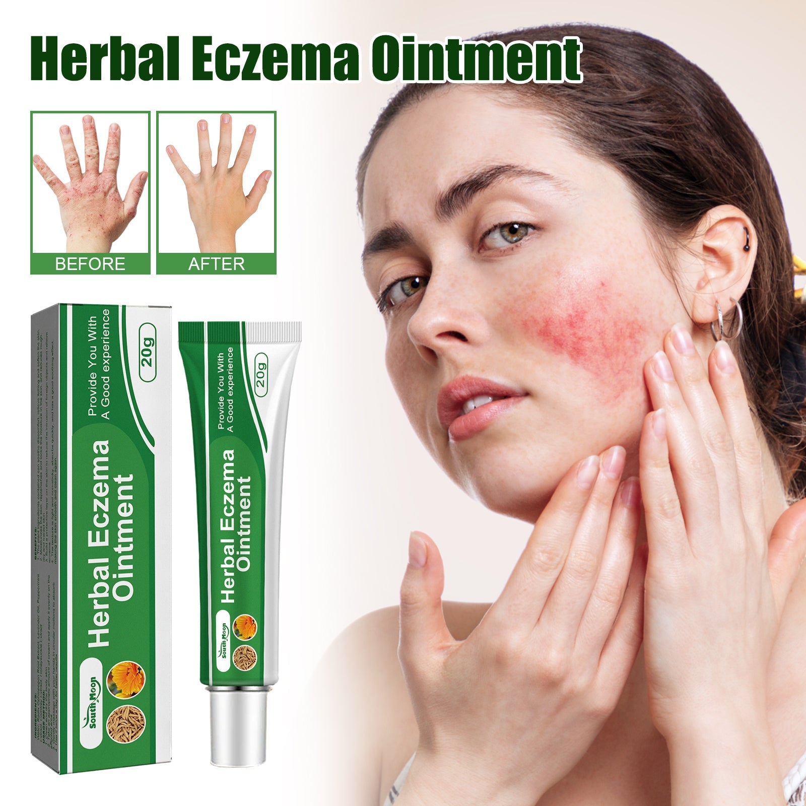 Side-by-side comparison of eczema-affected hand before treatment (red, inflamed) and after treatment (clear, smooth skin)
