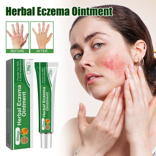 Eczema Ointment — Fast Itch Relief with Herbal Calendula Formula