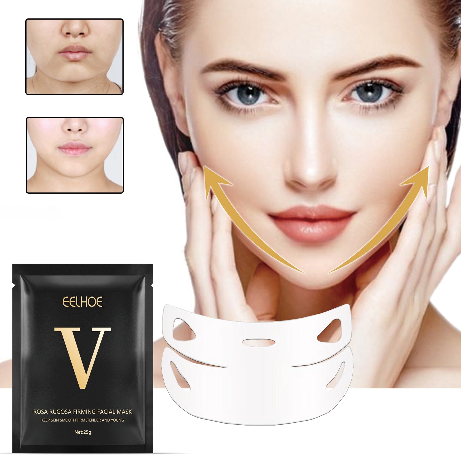 Problem areas highlighted: jowls, fat face, flabby skin, and marionette lines with gold borders