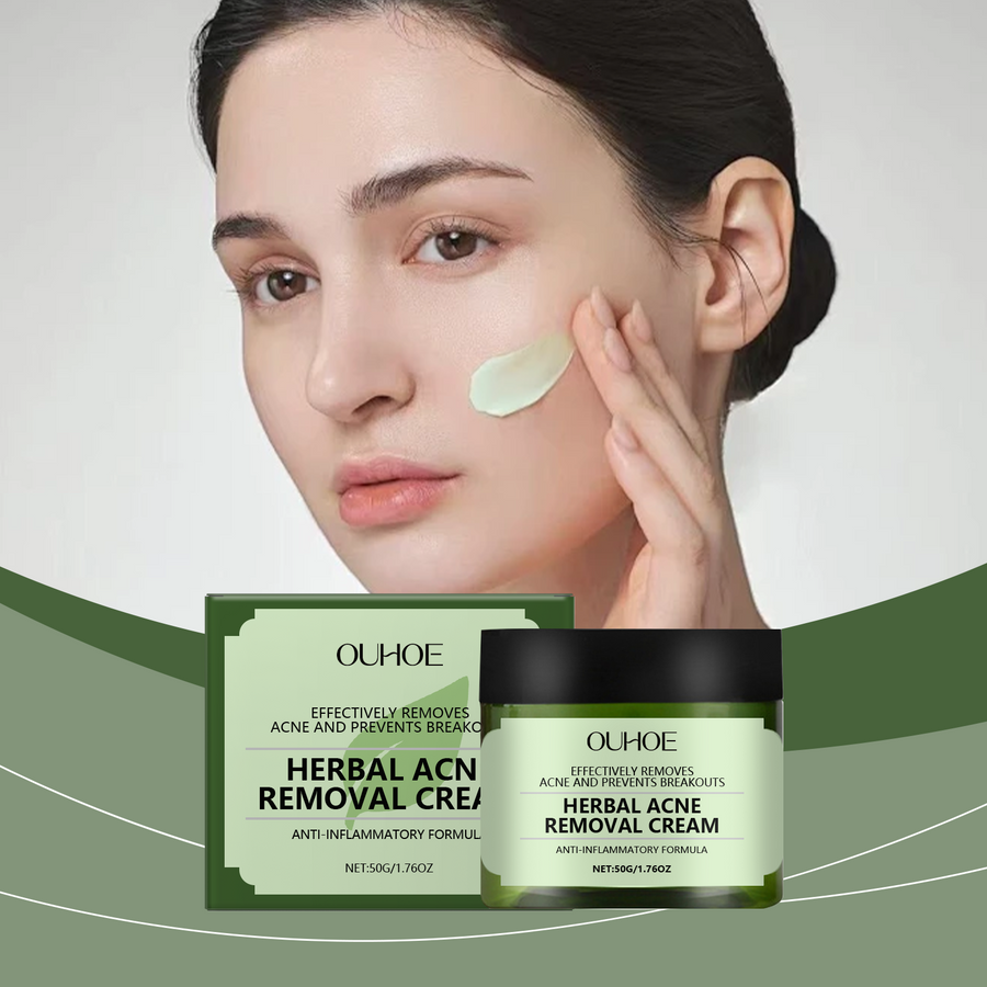 Herbal Acne Cream for Calmer, Clearer-Looking Skin