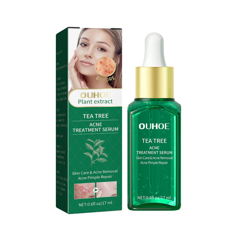 Tea Tree Oil Acne Serum — Clearer, Smoother Skin in 2 Weeks
