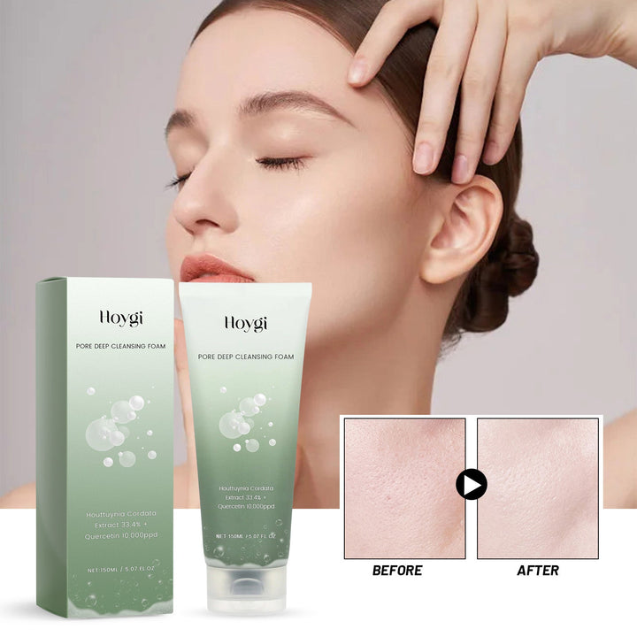 Houttuynia Pore Cleansing Foam for Oily Acne-Prone Skin
