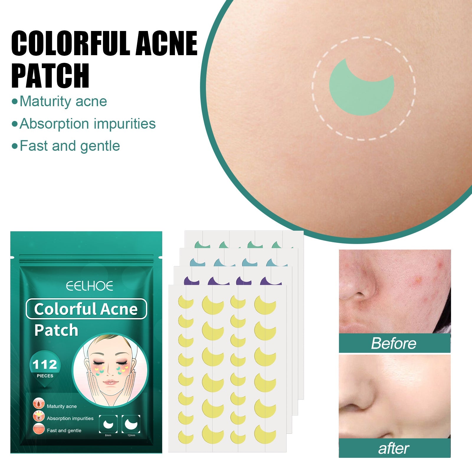 Detailed product benefits with close-up of teal patch on skin, before/after nose comparison showing visible acne improvement, and packaging display