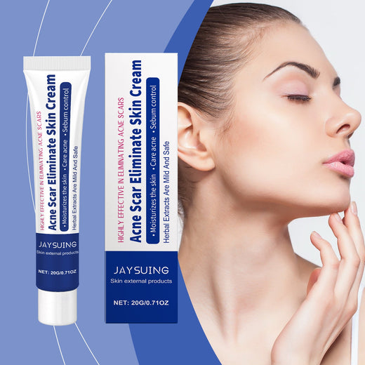 Acne Clearing Cream for Oily, Blemish-Prone Skin
