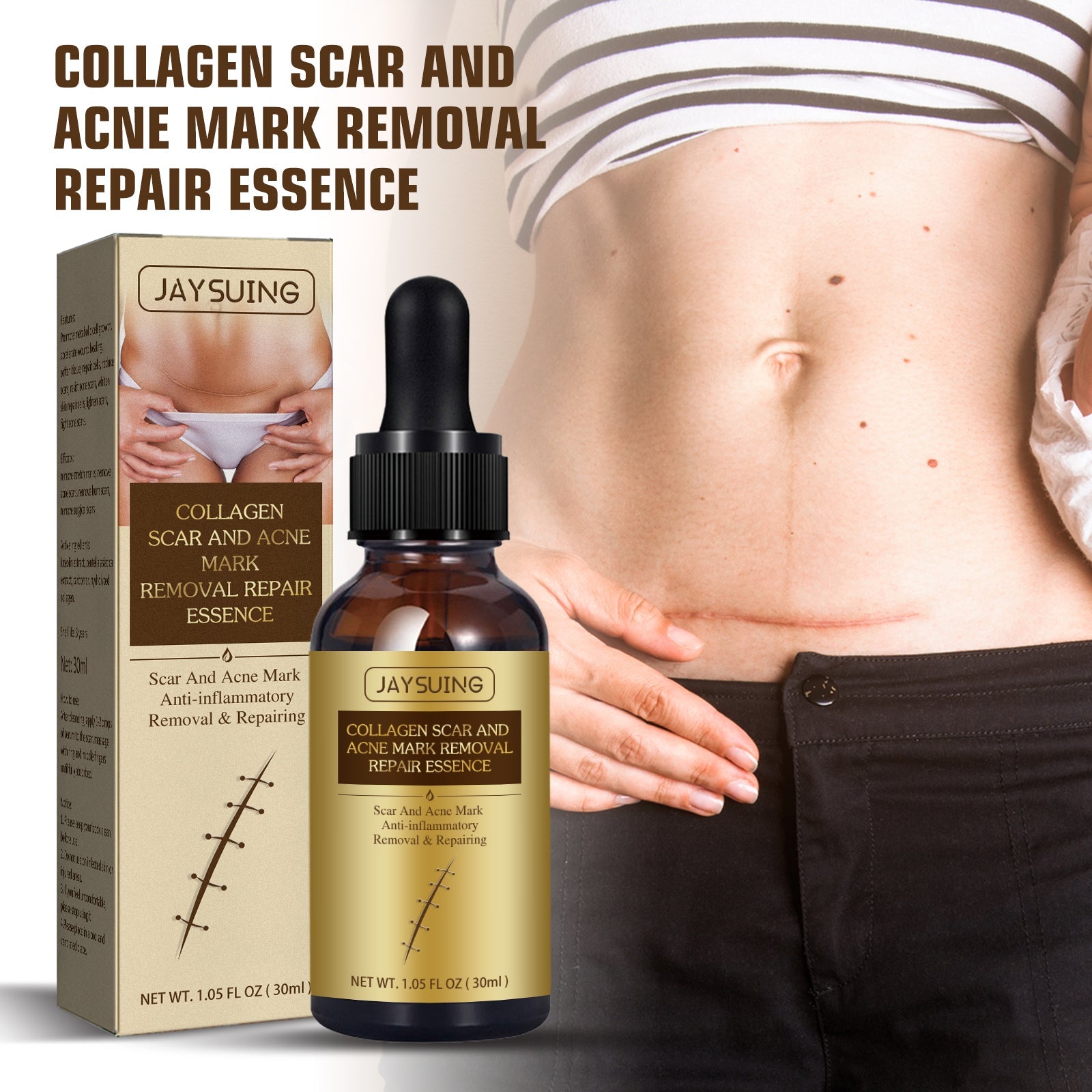 Woman applying essence to abdomen area with visible acne scars and marks on skin