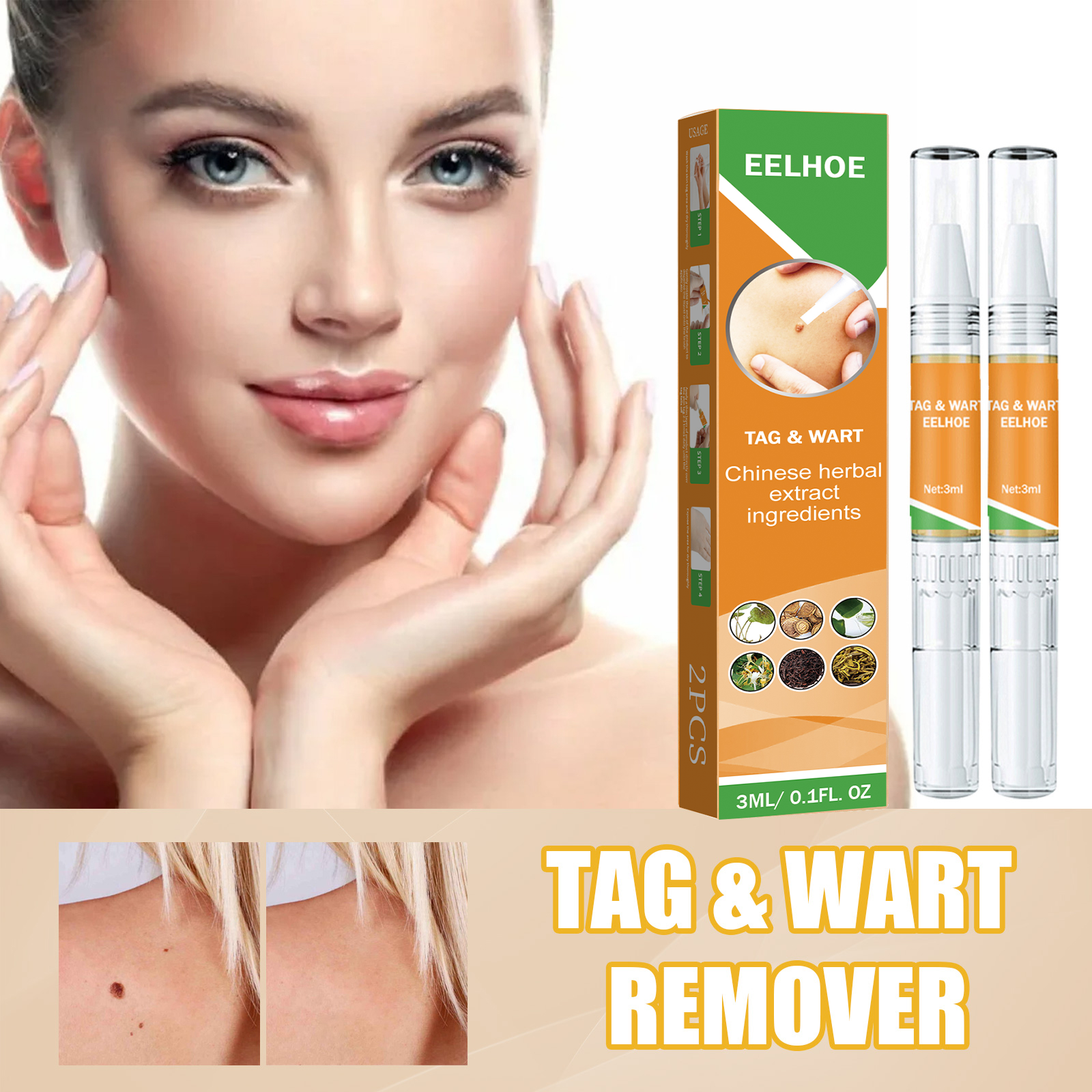 Glowing woman's face with hands touching cheeks and close-up of body with skin tag marking, plus product packaging and two pen applicators