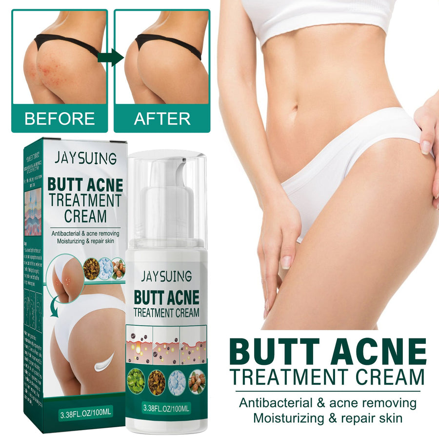 Butt Acne Cream for Smoother, Hydrated Body Skin Care