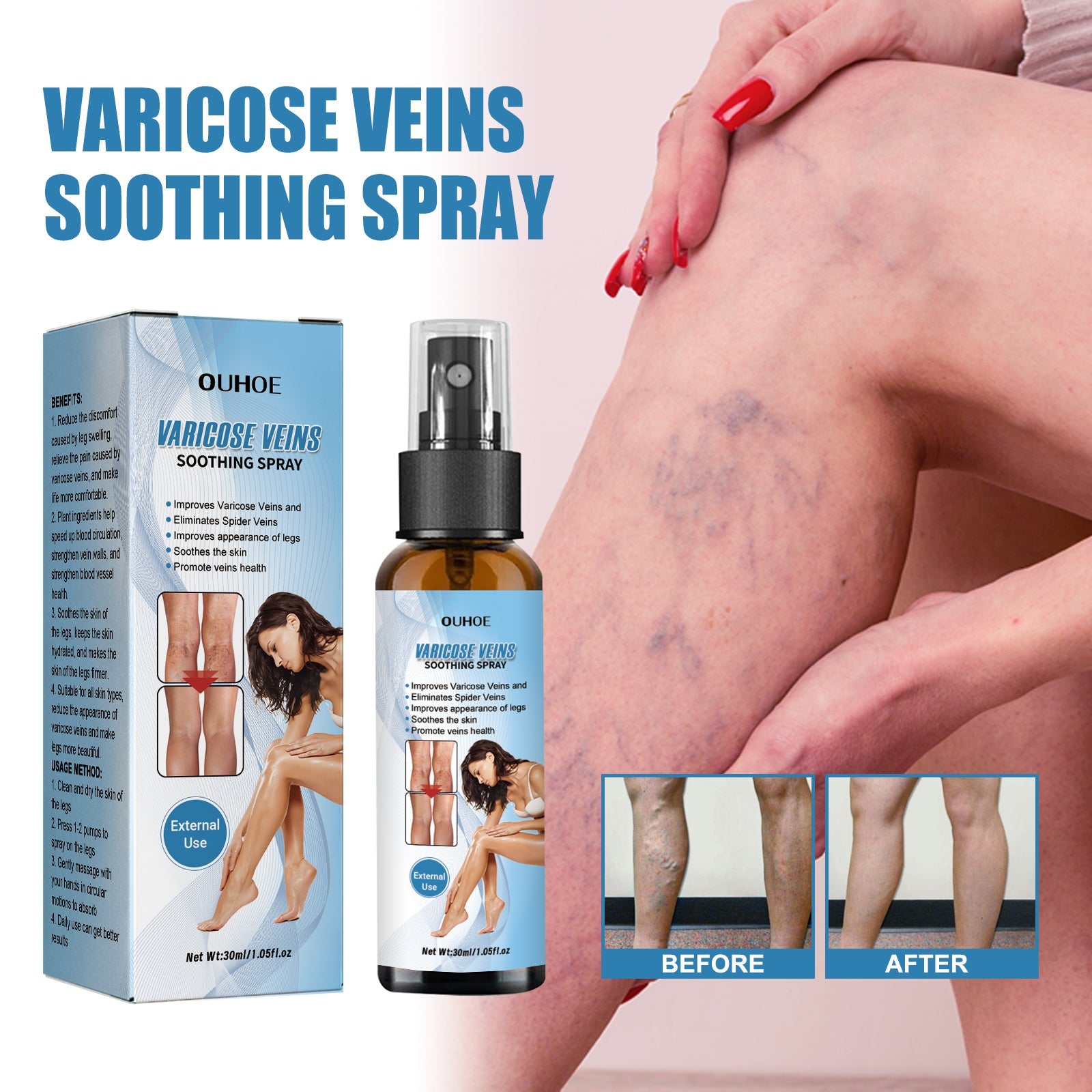 Identical hero layout with product packaging, spray bottle, and demonstrable before/after leg comparison imagery