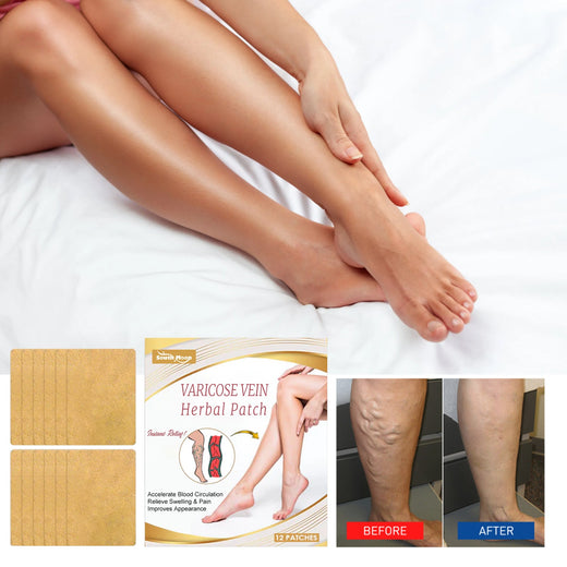 Varicose Vein Herbal Patch — Instant Relief & Smoother Legs
