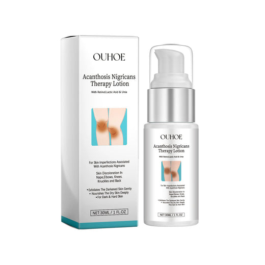 Acanthosis Nigricans Therapy Lotion for Dark Skin Patches