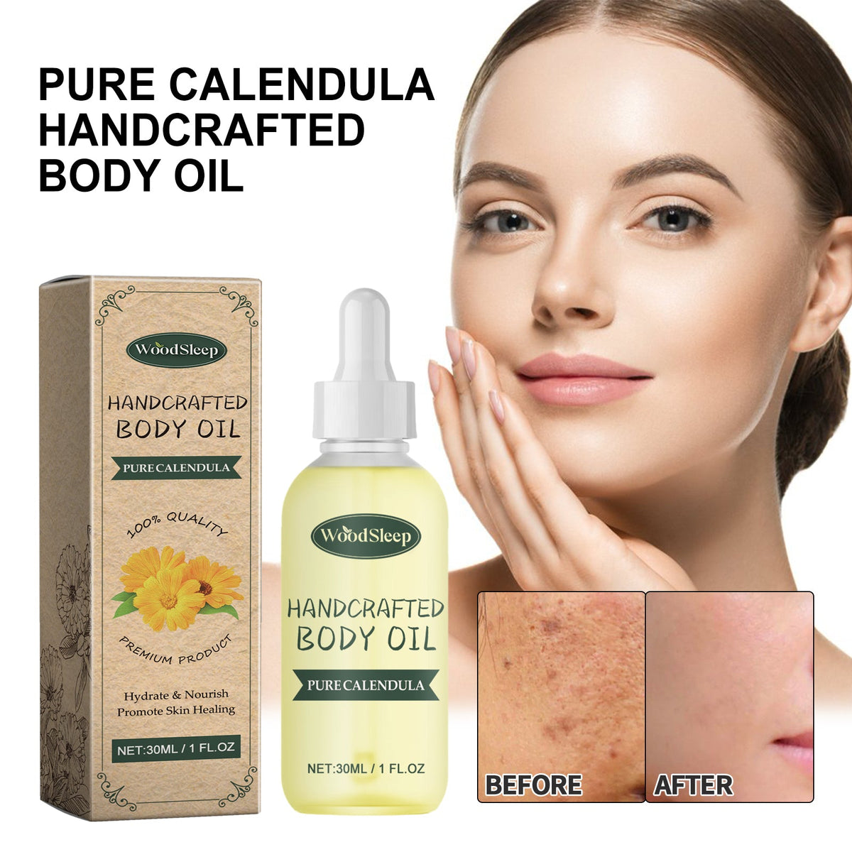 Calendula Body Oil for Dry, Red, Scar-Prone Skin Care