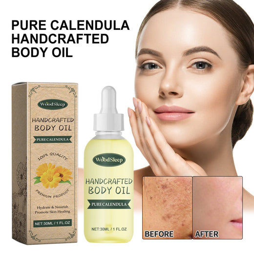 Calendula Body Oil for Dry, Red, Scar-Prone Skin Care